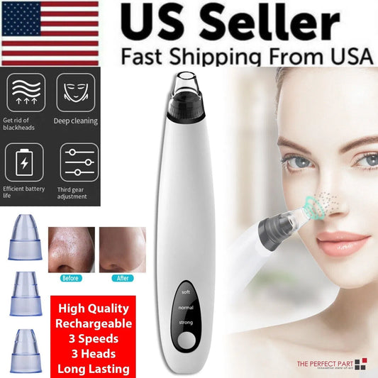 Electric Blackhead Remover Vacuum – Deep Pore Cleaner for Whiteheads & Acne Removal