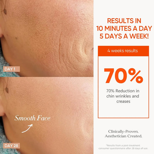 7 Color Cordless LED Face Mask For Wrinkle & Acne Reducing - Black